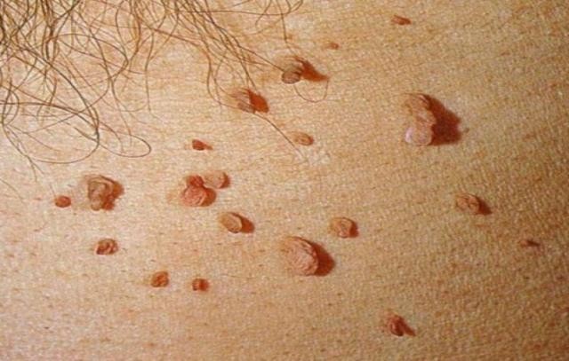 bőrparaziták elleni készítmények